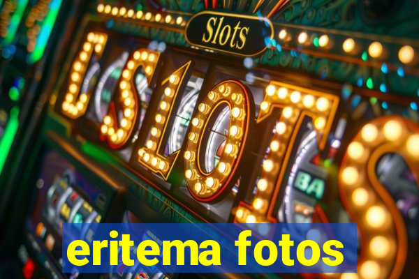 eritema fotos